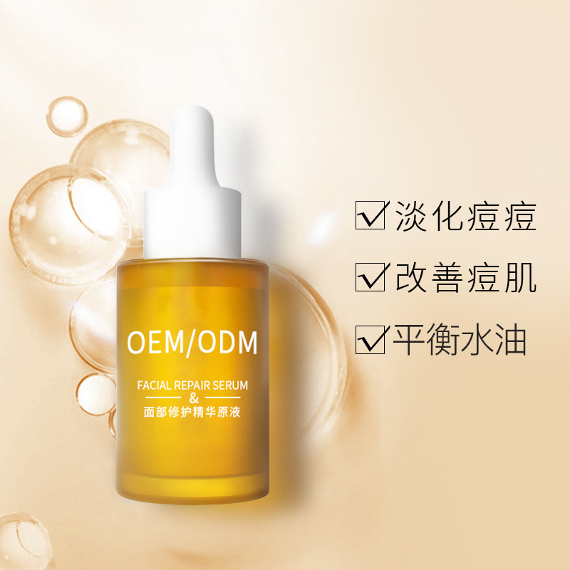 安植_祛痘精华原液OEM